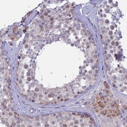 M1AP Antibody, Novus Biologicals:Antibodies:Primary Antibodies